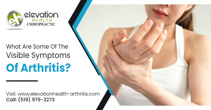 What Are Some Of The Visible Symptoms Of Arthritis?